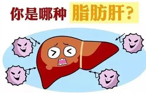 体检发现脂肪肝怎么办？轻松应对脂肪肝，听听肝胆专家是咋说滴！