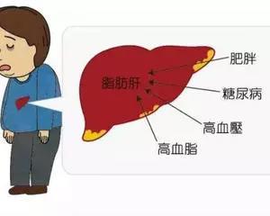医生说我有脂肪肝，是不是少吃几顿就好了？