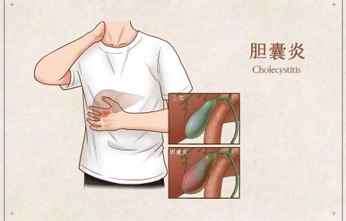 元宵节到了，胆囊炎患者适合吃汤圆吗？
